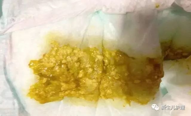 宝宝三个月大时一天排便次数正常范围解析